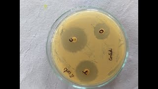 Antibiotic Sensitivity test Paper Disc Method Part 3 [upl. by Leacock835]