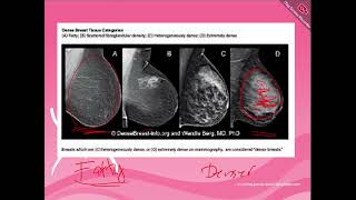 Mammography 1 [upl. by Lamb]