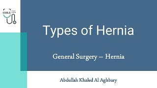 Types of Hernia  General Surgery  SMLE Crash Course [upl. by Hahsi]