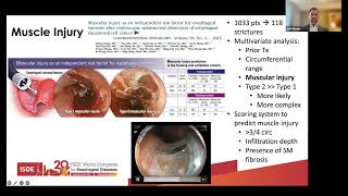 ISDE 2024  PostResection Strictures [upl. by Poore]