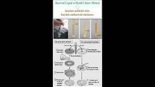 Different between Bacterial Liquid Culture Bacterial Spread Plate Culture and Bacterial Pour Plate [upl. by Signe]