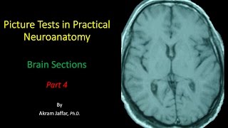 Picture Test in Neuroanatomy Brain Sections 4 [upl. by Meeki]