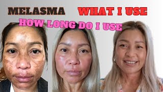 Darkspot amp Melasma what skincare I use and how long I have Melasma [upl. by Roee777]