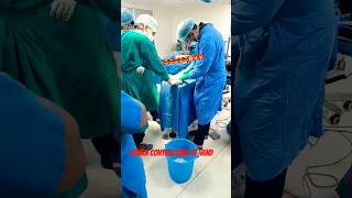 Burn contracture RT Hand viralvideo shortvideo shortsyoutube shorts surgeryrecovery [upl. by Encratia]