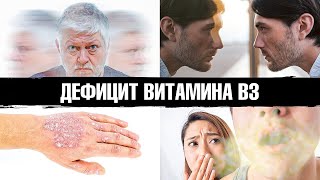 Симптомы дефицита ниацина витамина В3 которые вас шокируют😲 [upl. by Nies]