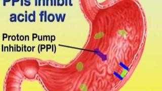 Esomeprazole Nexium [upl. by Card77]