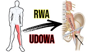 RWA UDOWA  ból pleców i drętwienie nogi  Ćwiczenia  ciekawostka 🧐 [upl. by Ailehs]