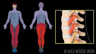 Nerve Root Block Injection Procedure Animation Video [upl. by Avrenim515]