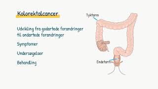 Fordøjelsesysstemet Kolorektalcancer [upl. by Ailecnarf207]