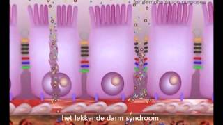 Lekkende Darm  Leaky Gut Syndrome [upl. by Leidgam]