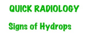 QUICK RADIOLOGY Radiologic signs of Hydrops [upl. by Wynne]