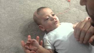 Baby Zacchaio 6 months old Complex Partial Seizure [upl. by Nayb484]