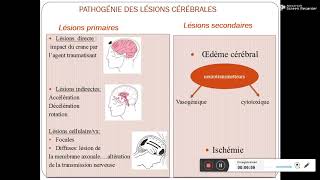 Traumatisme cranien Pr Daoud [upl. by Atrebla]