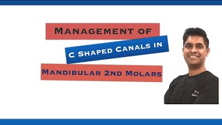 Endodontic Management of Cshape Canals [upl. by Alansen539]