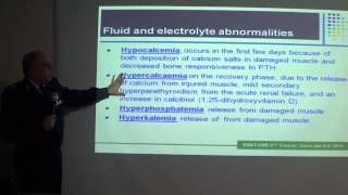 Rhabdomyolysis Prof Khaled Eweeda Air Force Specialized Hospital [upl. by Yelkao4]