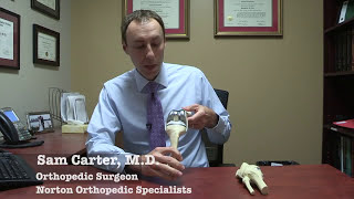 What is a partial knee replacement [upl. by Charry]