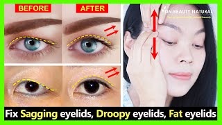 Get Big eyes view and natural Double eyelids Fix sagging eyelids droopy eyelids and fat eyelids [upl. by Tound]