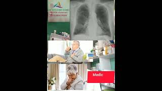 Bronchitis  শ্বাসযন্ত্রের সমস্যা  Acute Bronchitis  chronic Bronchitis [upl. by Ahkos]