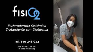 Esclerodermia sistémica tratamiento con diatermia [upl. by Kit211]