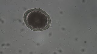 Toxocara canis vs Giardia size comparison [upl. by Kenny840]