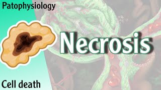 Pathophysiology  Necrosis cell death Hani Laith شرح [upl. by Dnomso611]