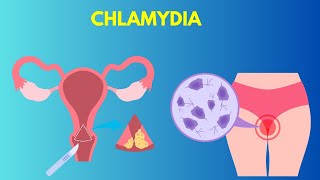 Signs and Symptoms of Chlamydia [upl. by Janice]