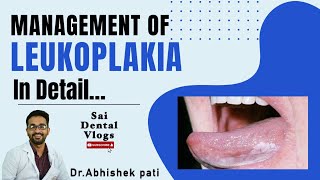 MANAGEMENT OF LEUKOPLAKIA IN DETAIL [upl. by Ongun]