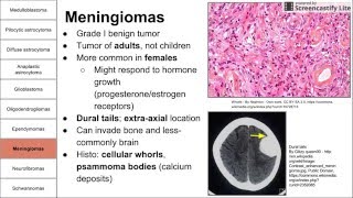 Nervous System Tumors [upl. by Ailel802]