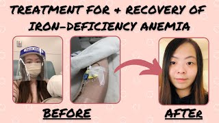 Iron Deficiency Anemia Treatment My Recovery Story [upl. by Henryetta]