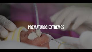 Prematuro extremos [upl. by Baten711]