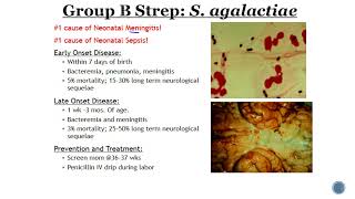 Group B Streptococcus GBS [upl. by Radford391]