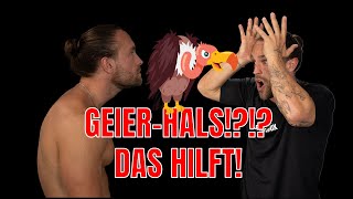 🔺GEIERHALS🔺 DAS HILFT [upl. by Jacy341]