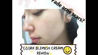 COSRX CENTELLA ASIATICA BLEMISH CREAM REVIEW  FADE ACNE SCARS [upl. by Georas453]