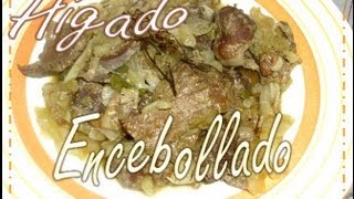 Hígado Encebollado [upl. by Paryavi209]