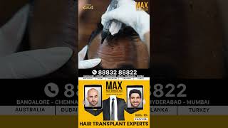 Transform Your Hair with Max Hair Clinic  Watch the incredible hair transformation of our Client [upl. by Rovert930]