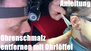 Ohrenschmalz entfernen mit Ohrlöffel  Ohrenschlinge benutzen zur Reinigung Anleitung [upl. by Kori615]