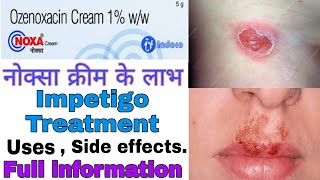 Noxa cream 1 use in hindi  Ozenoxacin 1 uses  Side effects  Best impetigo cream [upl. by Haet714]