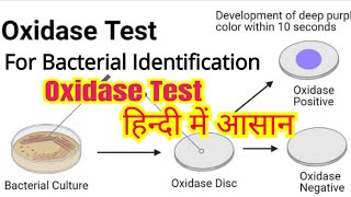 Oxidase test in hindi  Bacterial identification  Microbiology [upl. by Evaleen]