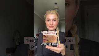 The best treatment for atrophic acne scars acnescars acne skinadvice skincaretips skincare [upl. by Seleta]