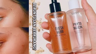 beruntusan  jerawat berkurang  Review Nacific Fresh Herb Origin Serum amp Phyto Niacin Essence [upl. by Aicetal]