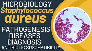 Staphylococcus aureus microbiology  Staph infection  Staphylococcus aureus pathophysiology [upl. by Doralia856]