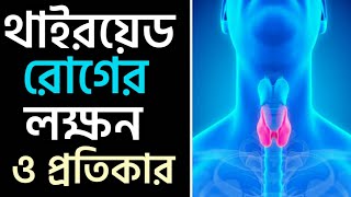 থাইরয়েড রোগের লক্ষণ ও প্রতিকার  Thyroid Symptoms Bangla  Health Tips Bangla  NEW [upl. by Adnawuj]