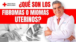 Miomas Fibromas qué son síntomas y tratamiento [upl. by Olenta]