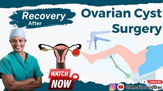 What does Recovery after an Ovarian Cyst Removal look like  TheFibroidDoc  Dr Cheruba Prabakar [upl. by Rafat]