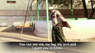 I have polio documentary [upl. by Etennaej]