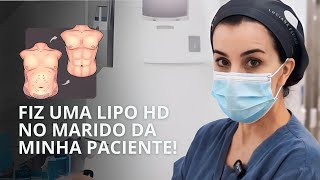 Lipo HD Masculina com Enxerto de Gordura no peito e deltoides [upl. by Kir]