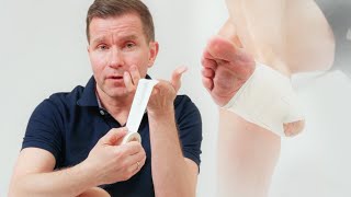 The most effective plantar fasciitis taping technique [upl. by Bainbrudge988]