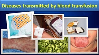 Diseases transmitted by blood transfusionClear over view [upl. by Armin]