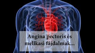 Angina Pectoris és mellkasi fájdalmak a GNM tükrében [upl. by Hpesoy]