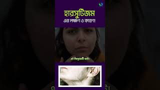 হারসুটিজম এর লক্ষণ এবং কারণসমুহ । Hirsutism [upl. by Quince42]